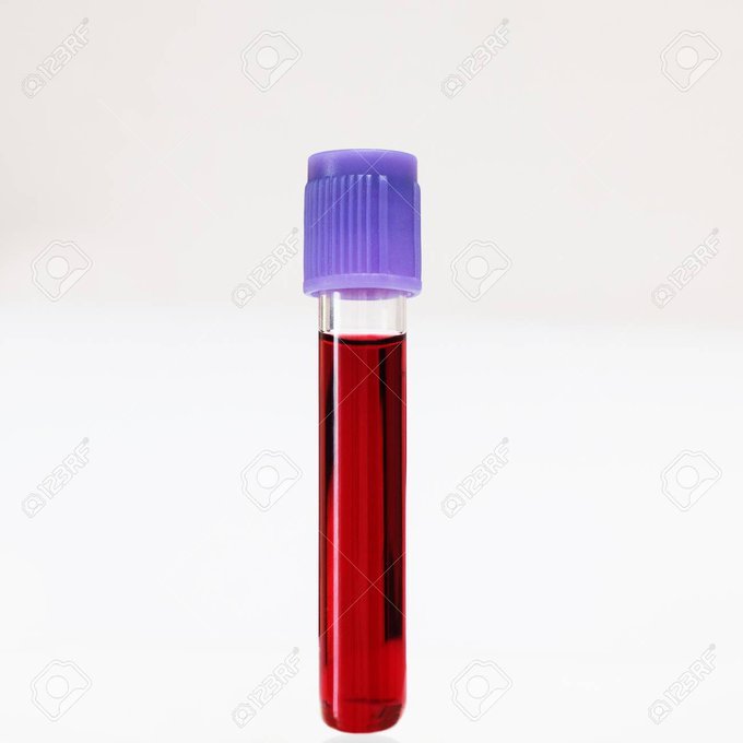 Amerikan Adalet Sistemi; Calvin Willis'in Hikayesi Mutlaka Oku